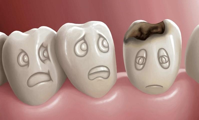 دندان‌پزشکی پیشگیری و جلوگیری از پوسیدگی