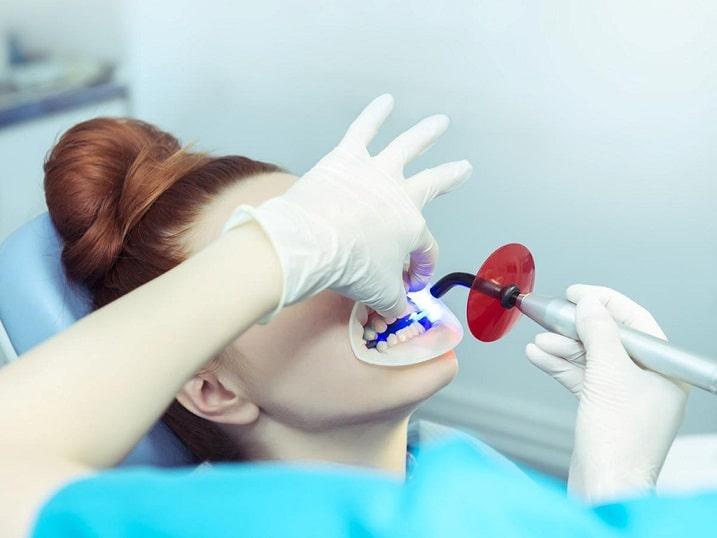 بلیچینگ یکی از روش‌های درمانی مورداستفاده در دندان‌پزشکی زیبایی است