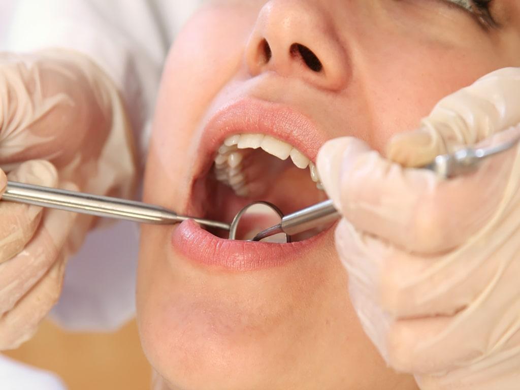 روش‌های تشخیص ابتدایی پوسیدگی دندان 