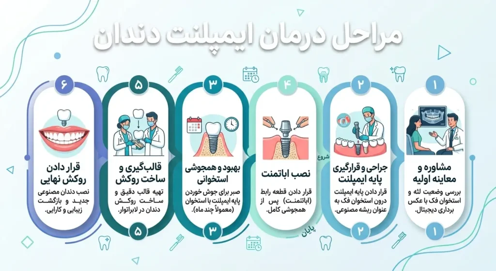 مراحل ایمپلنت دندان
