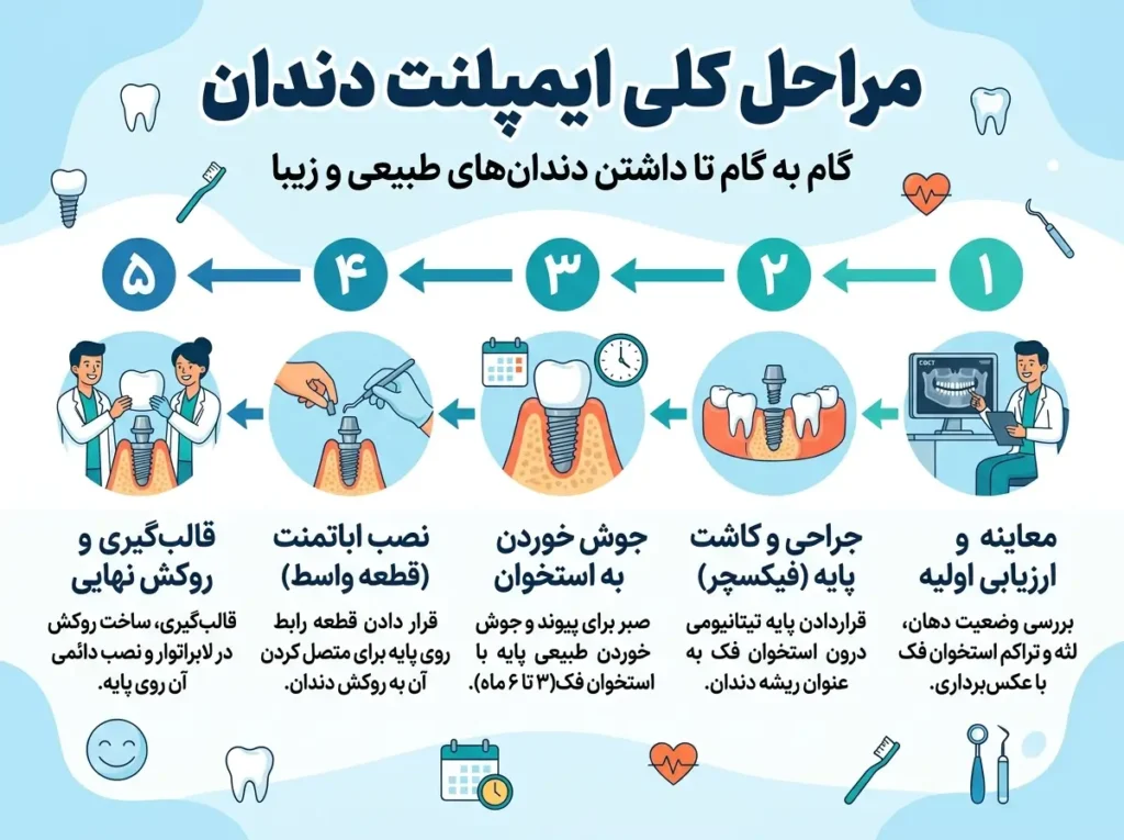 مراحل ایمپلنت دندان