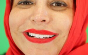 لمینت زیرکونیوم کاتانا