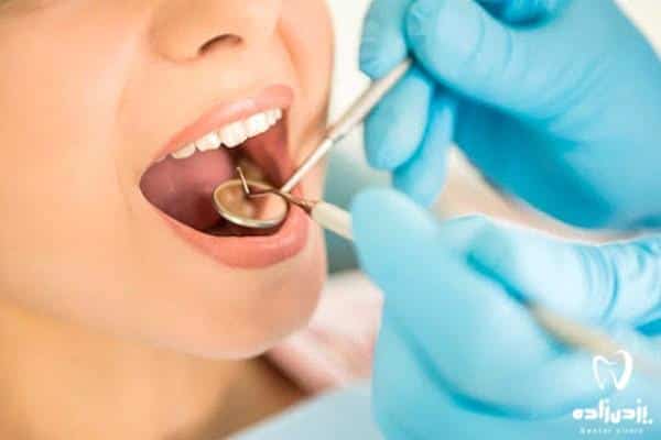انجام روش جدید در دندانپزشکی کم آسیب