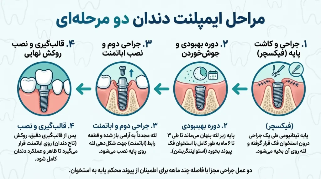 مراحل ایمپلنت دو مرحله ای