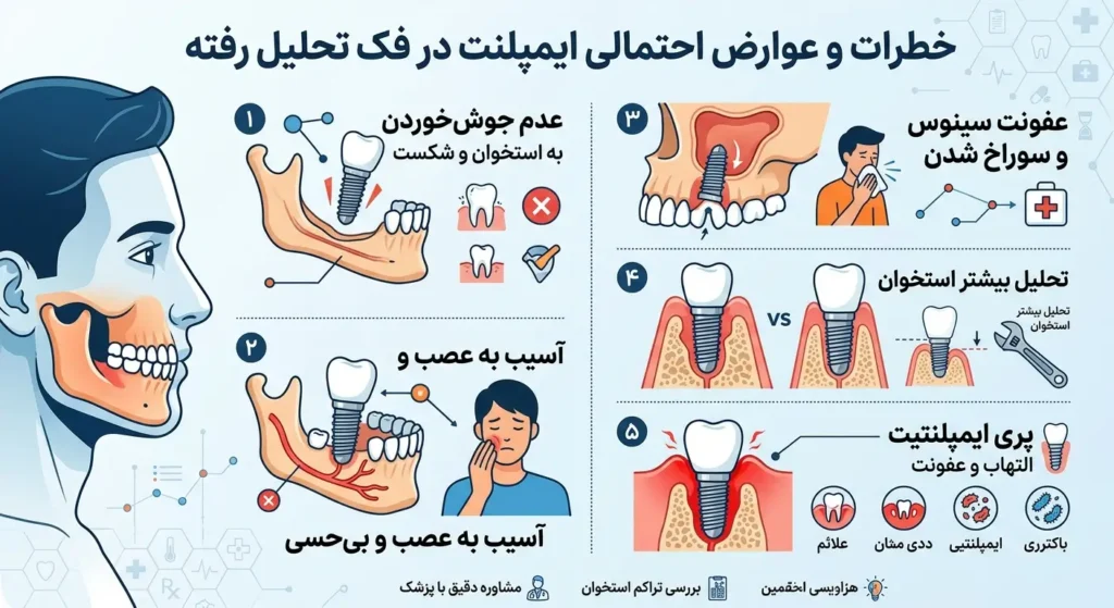 عوارض ایمپلنت برای فک هی تحلیل رفته 